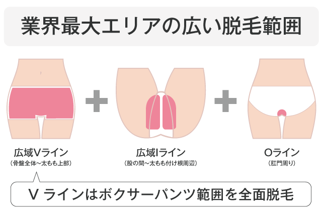 業界最大エリアの広い脱毛範囲 Vラインはボクサーパンツ範囲を全面脱毛