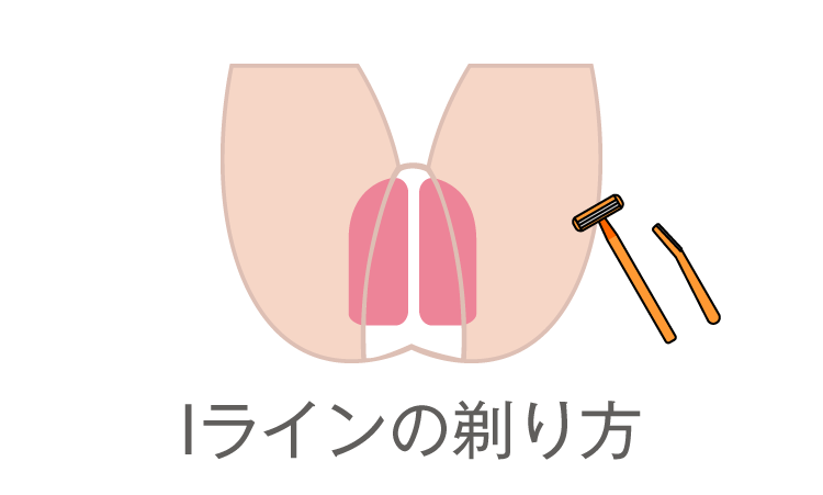 Iラインの剃り方