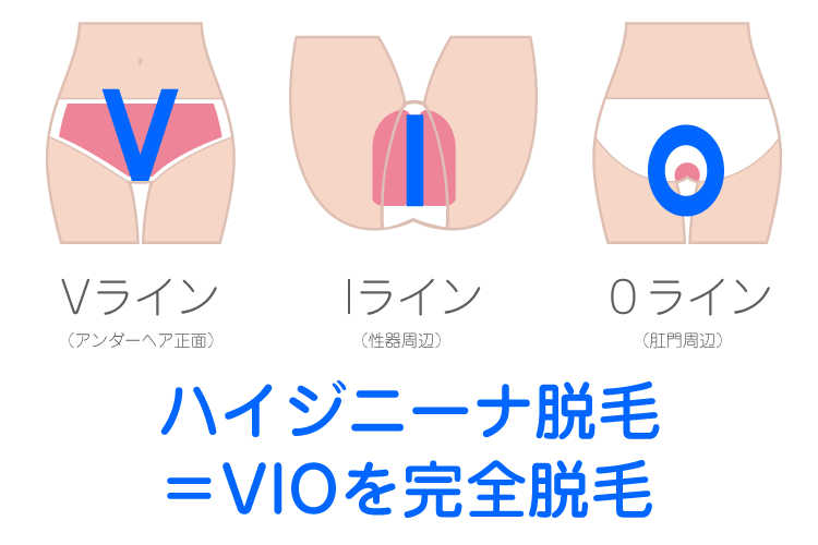 プリートのVライン/Iライン/Oライン それぞれの範囲