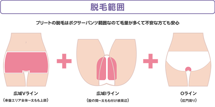 脱毛範囲　ボクサーパンツ範囲なので毛量が多くて不安な方でも安心です