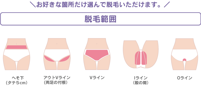 お好きな箇所だけ選んで脱毛いただけます